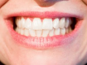 Teeth can be strengthened easily and cheaply